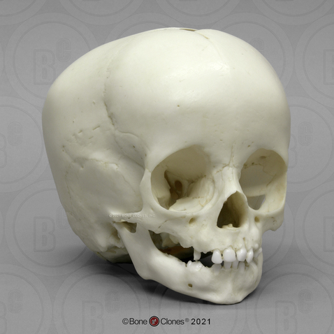 1-year-old Human Child Skull