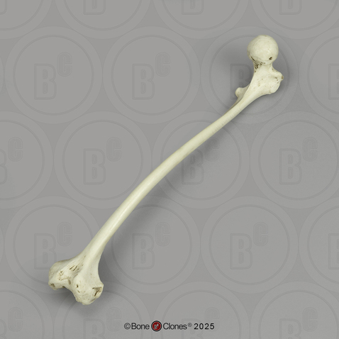 Human Left Femur, Polio Human Left Femur, Polio