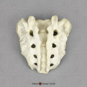 Human Sacrum with Spina Bifida