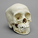12-year-old Human Child Skull, with Dentition Exposed