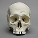 Human Male Skull with Hammer Blows