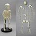 Human Female Achondroplasia Dwarf Skeleton