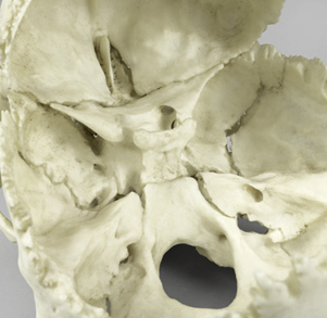 Medical Study Skull